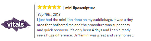 Vitals review: I just had the mini lipo done on my saddlebags. ... - 5 stars